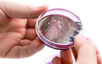 Bakterie v sekreci prostaty